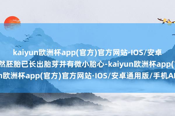 kaiyun欧洲杯app(官方)官方网站·IOS/安卓通用版/手机APP下载诚然胚胎已长出胎芽并有微小胎心-kaiyun欧洲杯app(官方)官方网站·IOS/安卓通用版/手机APP下载